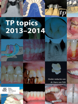 cover image of TP topics 2013-2014
